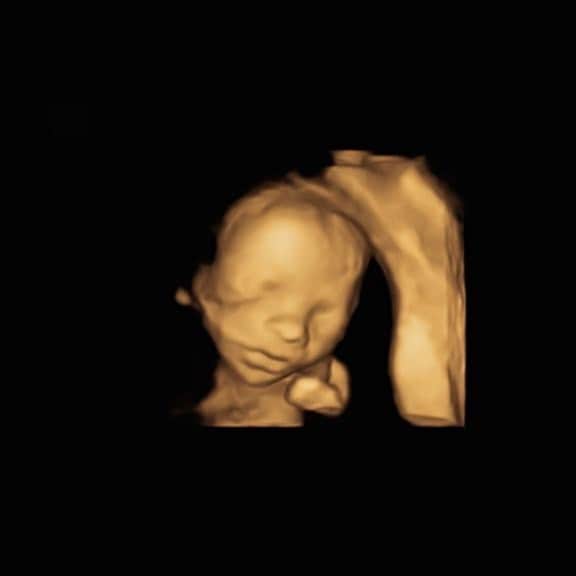 ジョージア・コウソウロウのインスタグラム：「Oh baby we can’t wait to meet you ..🥺 Who do you think the baby looks like?」
