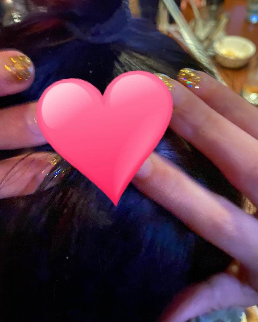 AD久保田（久保田樹里）のインスタグラム：「多発型？ハゲました😂  精神的な限界が来ました。  何科に行けばいいですか😭？？」