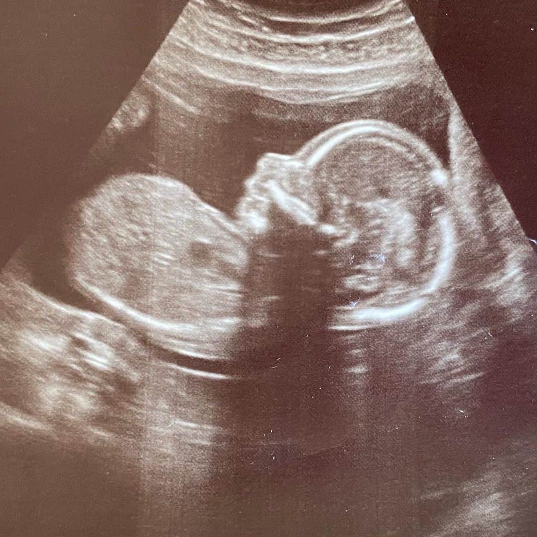 アレクサ・ヴェガのインスタグラム：「Oh you little sweet blessing! 💜❤️✝️ (💖💙💖💙💖💙) Little boy or little girl? Also, thoughts and opinions on waiting to find out? And if you didn’t wait how did you do your gender reveal? 🥰」