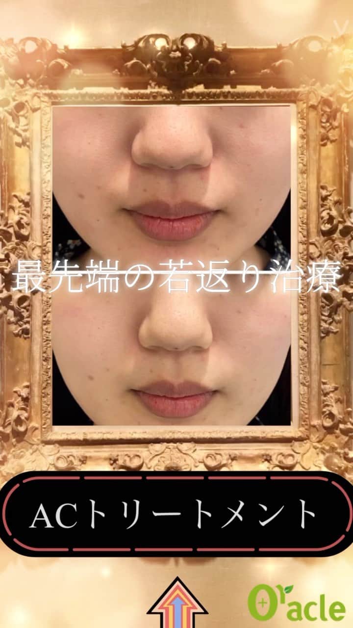 オラクル美容皮膚科東京新宿院のインスタグラム