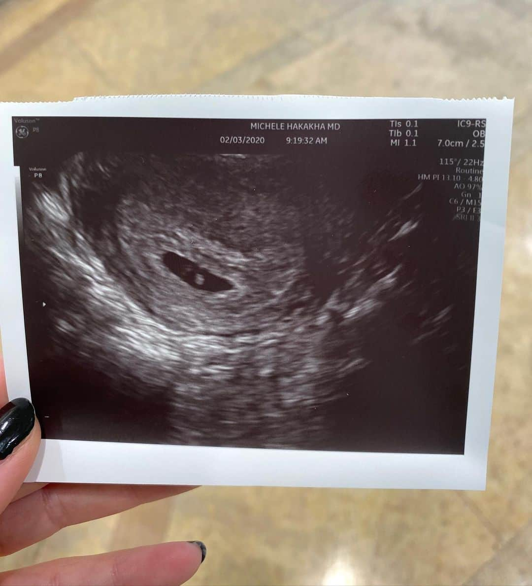 ビリー・ラードのインスタグラム：「🤯😭🤯1 year ago today I had my first ultrasound and today I have a laughing smiling little human sitting on my lap (?!?!!!!!) #cryingintheclub #excepttheclubismycouch」