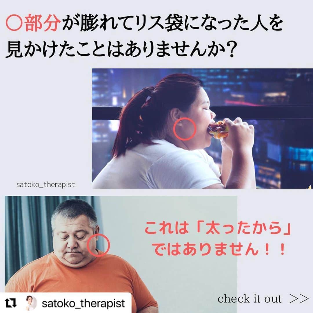 笑顔をリフォームする@健康小顔職人のインスタグラム：「． 噛み締めの強い方 むくみやすい方、などに多い症状…  『お顔にリス袋🐿』 ． @satoko_therapist ちゃんが詳しく解説してくれています！ ． 小顔職人の手技はできてしまったリス袋🐿をしっかり解します🤩 ． 詳しくはHPをご覧ください！ 2月のご予約受付中です💕 換気、アルコール消毒、予約制限、営業時間短縮などコロナ対策に気をつけながら営業しています！ ．  世界中の皆様が安心して過ごせる日々が早く訪れますように🌈✨ ． #小顔職人 #小顔マッサージ #小顔サロン #小顔整体 #小顔エステ #小顔になりたい #小顔矯正  ． #Repost @satoko_therapist with @make_repost ・・・ 【お顔にリス袋🐿できていませんか？】﻿ ﻿ 写真のようにリス袋ができている人を見かけた事はありませんか？﻿ 実はこれの正体は『耳下腺リンパ節』の滞り。﻿ そこに老廃物が溜まっているのです。 決して太ったからではありません！﻿ ﻿ そうなってしまった原因の一つは以前﻿ #小顔美容整体技士の咬筋アプローチ でも﻿ お伝えした「咬筋」の使い過ぎです💦﻿ 鍛えられ過ぎた咬筋が邪魔をして耳下腺リンパ節も詰まってしまうのです😱 ﻿ 食べ物の咀嚼やストレスによる噛み締め等で﻿ 日常的に酷使されている「咬筋」を解す事は勿論必須事項なのですが、﻿ リンパを正しい方向に流すアプローチもリス袋やエラ張りを無くす要となります。﻿ ﻿ サロンでの施術でもばっちりアプローチしています👍﻿ 詰まりが酷い方や噛み締め癖がある方は、時に「ひーーー！🤣」と仰いますがそこは愛のムチです！笑﻿ ﻿ ご自分でケアする場合は3枚目写真の要領で流ましょう💆‍♀️﻿ 順番を間違えるときちんと流れなかったり、逆に腫れてしまったりします😅﻿ ﻿ 余談ですが（それでも何となく言いたい笑）﻿ TVを観ていてリス袋ができている人って強そうに見えるけど日常的に何らかのストレスを抱えて生きていたり、堪えてらっしゃるんだろうなーと思う事が多々あります。﻿ ﻿ ここでは名指ししませんが、政治家の方に多いように感じます🤫﻿ アメリカの元のあの方とか、日本でもチラホra...﻿ ﻿ この様にお顔の状態によって性格や生き方がわかるのも面白いんです🙊﻿ ﻿ =============================﻿ ◼︎施術のご予約は﻿ ▷@satoko_therapist url🔗から💆‍♀️✨﻿ ﻿ ◼︎現役セラピスト國枝さとこが本気で作る温活アイテム♨️﻿ #nakeda_alphaハーブパット﻿ ▷@nakeda_alpha →完売致しました🙏﻿ ﻿ ◼︎ @kogao_shokunin × @nakeda_alphaコラボ﻿ 『エンジェルハーブパット』👼✨﻿ →完売いたしました🙏﻿ ▷@happy_cosme_kogaoshokunin ﻿ =============================﻿」