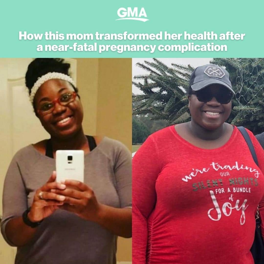 Good Morning Americaさんのインスタグラム写真 - (Good Morning AmericaInstagram)「Tricia Bryan, 34, of Conyers, Georgia, has lost nearly 60 pounds after a near-fatal pregnancy complication. Link in bio for her story and advice for others.」2月5日 13時01分 - goodmorningamerica