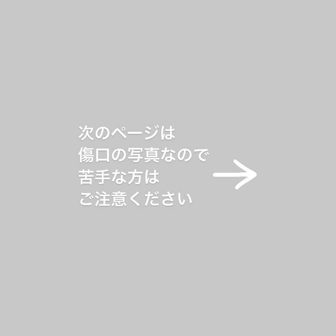 こむぎさんのインスタグラム写真 - (こむぎInstagram)「* 引き続きししくんのことです😭 (4枚目の写真は傷口なので苦手な方はスワイプご注意ください🙇🏻かなり治りましたが念のため🙇🏻)  今日も預かりさんに病院へ行ってきていただきました🙇🏻 ししくん、今週中には退院出来そうとお伝えしていたところでしたが、残念ながらそれが叶わずでした…😢  最初の破裂の大きな傷はかなり治ったのですが、上の方にまた少し赤いびらんのようなものが再発💦膿瘍まではいっていないようですが来週退院は様子を見てからにしましょうとなりました🙇🏻  ししくんの皮膚が弱いのは血行が元々良くないからとのことです💦今また血行が良くなるお薬を取り寄せ中とのことで、届き次第そちらも塗っていくそうです😢  一時期体重が3キロ切って2キロ台になってしまったようですが、少しずつ自分で食べ始めて3キロ台に戻ってきています。  元々は4キロ台だったししくん。 段々と痩せてしまったけど、傷が癒えて落ち着ける環境になったら、もっとたくさんモリモリ食べてまん丸になってね😭  血行を良くするレーザーを1日2回10分ずつあてる温熱療法という治療もしてくださっています。 ししくんのために出来ることやってくださっていると思うので、あとは信じて祈るばかり…😭✨✨  4枚目の背中の写真は下の方の傷は治り上の方に赤い斑点がありそれが再発したもの。 5枚目の動画は昨日の撮影のものですがネムネムのししくん😴  昨日からサイレントシャーも出来る様になり元気になってきているとのことです！！💪 退院延びちゃったけど、しっかり治そうね😭 ししくん頑張って〜😭😭  ししくんのためにたくさんの応援本当にありがとうございます🙇🏻 青井さんともしかしたらししくんの入院費足りないかも💦とワタワタしていたところ、今月にも支援金を入金してくださった方もいてなんとか入院費は大丈夫かな？と！！😭✨ 助かりました〜🙇🏻✨✨  ただ、今後の通院費(傷の洗浄が必要な場合は1日おきに受診、洗浄が必要ない場合は1週間に1回の受診になるとのこと)、そしてししくんだけではなく免疫介在性溶血性貧血のつばめくんの受診、アレルギーのリスちゃんの受診もあります…😢 まだ準備途中なのですが、今月どこかでチャリティーウェブショップもやりますね😭💦  引き続き応援何卒よろしくお願いします🙇🏻 毎日献身的に病院へ行ってししくんの様子を見てきてくださっている預かりの @takanokenoneko.399 さん。本当にありがとうございます😭✨  #岐阜多頭崩壊レスキュー」2月6日 18時22分 - tomochunba