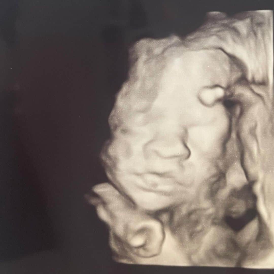 ナタリア・ベッカーのインスタグラム：「Estamos te esperando, bebêzinho! ❤️ Foto 1: baby #3 Foto 2: Matteo Foto 3: Helena  . Que emoção é ver nossos bebês assim! Compartilhei foto de todos os 3 ❤️   “Tu criaste o íntimo do meu ser e me teceste no ventre de minha mãe. Eu te louvo porque me fizeste de modo especial e admirável. Tuas obras são maravilhosas! Digo isso com convicção. Meus ossos não estavam escondidos de ti quando em secreto fui formado e entretecido como nas profundezas da terra. Os teus olhos viram o meu embrião; todos os dias determinados para mim foram escritos no teu livro antes de qualquer deles existir.” ‭‭Salmos‬ ‭139:13-16‬ ‭NVI‬‬」
