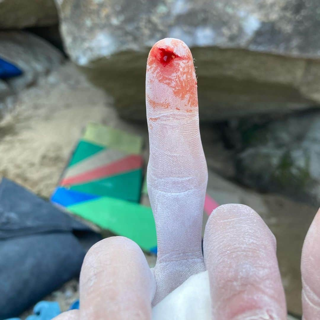 濱田健介さんのインスタグラム写真 - (濱田健介Instagram)「My finger was splitted🖕  It’s a still project...  昨日今日と笠置で久々にPをトライ。  ムーブも出来ていい感じかと思いきや、指をパックリやっちまったー。  写真では大した事なさそうやけど、この後マジで引くくらい出血した🩸🩸🩸  こりゃ治るまで、だいぶかかりそう。。 しばしお預けやな。  #笠置ボルダー   @rockmasterhq  @unparallelup  @organicclimbing  @nogradjustfeeling」2月6日 23時24分 - hamaken87