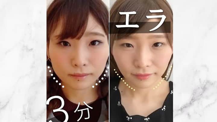 のインスタグラム：「あとから見返したい人は【保存マーク】👆💫 今回のような内容が好きな人は【いいねボタン】👍🏻💫 で教えてください👨‍⚕️ . ============================= . 【3分エラツボマッサージ】  こんばんは、美容整体師の川島です👨‍⚕️  今回は今井美桜と田﨑さくらさんと一緒に エラ張りを解消するツボを 紹介していきます！ . POINTは、、、、 咬む筋肉のツボをしっかり捉えることです！ . ＜やり方＞ １、頬骨の少し下の筋肉を潰すように押す 2、こめかみとエラの間の筋肉を潰す 是非試してみてね🙆🏻‍♂️ . 川島さんと一緒に 運動したい人はYoutubeで😊 . #整体Filament #川島悠希 #整体 #マッサージ #ダイエット #運動 #トレーニング #下半身 #下半身痩せ #宅トレ #宅トレダイエット #運動不足解消 #トレーニング女子 #トレーニング動画 #ダイエット方法 #ダイエット生活 #ダイエット仲間募集 #ダイエット部 #美容垢 #美容垢さんと繋がりたい #美容大好き #美容好き#ストレッチ#エラ #エラ張り #小顔マッサージ #小顔になりたい #小顔美人」