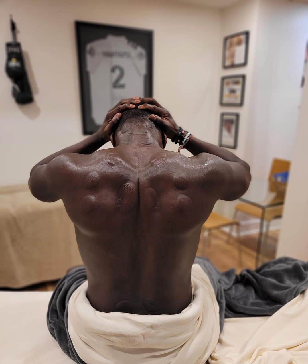 バカリ・サニャさんのインスタグラム写真 - (バカリ・サニャInstagram)「Do you know about cupping’s benefits on the body ...   ▪️it releases muscle tensions  ▪️it increases blood and lymphatic circulation ▪️it eliminates muscle tissues adherences   Treatments by : @mkinesitherapy #montreal #health #selfcare #cuppingtherapy」2月7日 5時48分 - therealbac