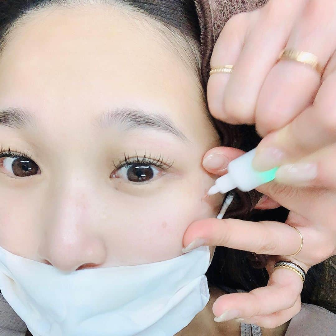 世手子さんのインスタグラム写真 - (世手子Instagram)「I went out with a mask that changed color😷 Amazing eyelash salon where you can also take care of stains✨✨ Looking forward to follow-up👁🌟 @salon_redmoat  #redmoat #川崎マツエク に行ってきました(*^_^*) シングルでこんなにゴージャスになるなんてびっくり(´∀｀) しかも #シミケアサロン も兼用しているという素晴らしさ！ 初めて #シミケア やってみたー！ お手頃価格でシミだけ反応して黒くなって1週間後ぐらいにぽろっと剥離するんだってー！！ すごいね(≧∀≦) 経過観察中だよ\(//∇//)\ 産後とかでシミできてたの全然気がつかなかったし こんな簡単にシミがおちるなんて知らなかったーー 結果が楽しみだ(๑>◡<๑) #光マスク #HIKALUS 付けたよー！ さりげないオシャレ❤️ スワイブしてみてねー #川崎まつ毛 #川崎マツエクサロン #pr #トリドリベース」1月14日 12時50分 - rojide