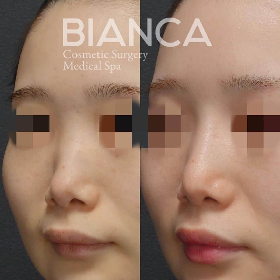 辻沢由有（BIANCA CLNIC 表参道院 院長）のインスタグラム