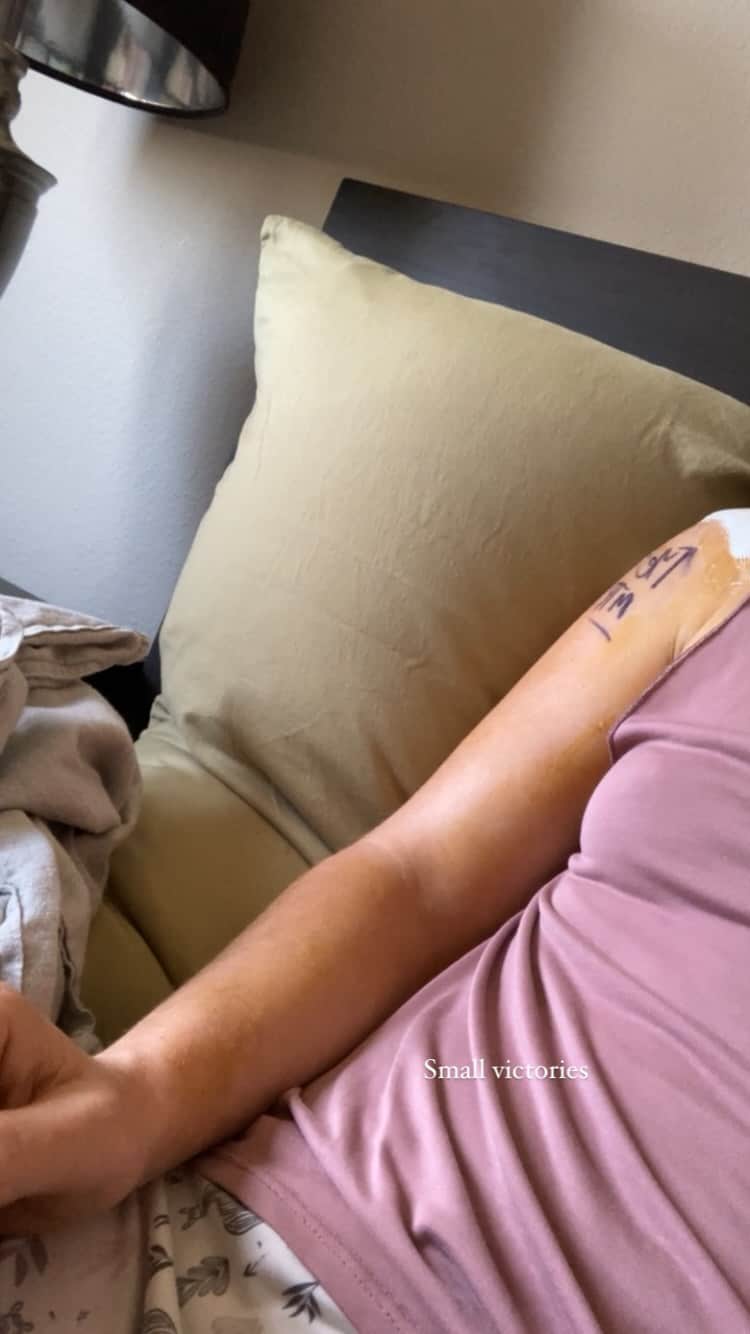 チェルシー・ルーズのインスタグラム：「Gotta keep things moving where I can. It’ll be 5-6 weeks without actively moving my shoulder (can have others move it passively) but still need to say hello to biceps and forearms!   72 hours post op.」