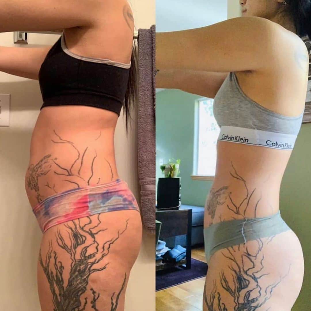 Ainsley Rodriguezさんのインスタグラム写真 - (Ainsley RodriguezInstagram)「LETS TALK CELLULITE!! Give it up for my client Katrina after just 4 weeks with me! . SO many of you ladies flood my DM in disbelief that my clients are able to reduce the appearance of their cellulite because ‘you can’t get rid of it’. That last statement is true - there is no ‘cure’ for cellulite but you can definitely reduce the appearance of it! . Most of us DO have cellulite and it occurs when connective fibers under the skin become weak or lose their elasticity, but stretching and strengthening those areas (in addition to burning away excess fat overall) can help! Notice how I said STRENGTHENING - this means that if you’re suffering from cellulite, strength training and building muscle are going to help tighten the area and cardio is NOT your answer! . Diet and exercise alone won’t determine if you get cellulite or not but it can help those connective fibers responsible and sure as heck can help reduce the appearance of it! 😍 . Client spots for next week NOW OPEN! DM your email for info 📬」1月17日 10時32分 - ainsley