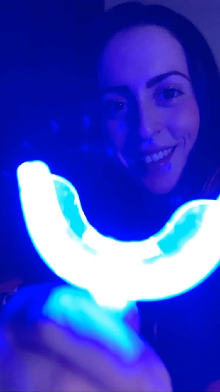 アレッシア・ポリエリのインスタグラム：「Vi presento i prodotti di @smilesecret_com per lo 𝐬𝐛𝐢𝐚𝐧𝐜𝐚𝐦𝐞𝐧𝐭𝐨 𝐝𝐞𝐧𝐭𝐚𝐥𝐞 🦷  1- 𝓟𝓱𝓸𝓷𝓮  𝓫𝓵𝓮𝓪𝓬𝓱𝓲𝓷𝓰. L'applicazione del kit per lo sbiancamento dei denti richiede uno smartphone 😍 Il gel sbiancante è composto al 100% da ingredienti naturali, è stato sviluppato da dentisti e senza perossido di idrogeno, delicato su denti e gengive. La combinazione di 16 LED di potenza e il gel può schiarire i denti di diverse tonalità.  2- 𝓒𝓸𝓬𝓸  𝓫𝓾𝓷𝓭𝓵𝓮. composto da polvere di carbone attivo CocoSmile, striscia sbiancante Coco Strips, dal dentifricio con polvere di carbone attivo e dallo spazzolino BambooBrush. La combinazione perfetta dei migliori prodotti sbiancanti per denti. Risultati visibili dopo 2-3 applicazioni Garanzia di rimborso di 30 giorni per risultati non evidenti.   Vi lascio il mio 𝐜𝐨𝐝𝐢𝐜𝐞 𝐬𝐜𝐨𝐧𝐭𝐨: 𝒂𝒍𝒆𝒔𝒔𝒊𝒂𝒔𝒆𝒄𝒓𝒆𝒕 per ottenere -30% su tutti i prodotti presenti nel sito! https://serv.linkster.co/r/gAdkho5L  #smilesecret #sbiancamentodentale」