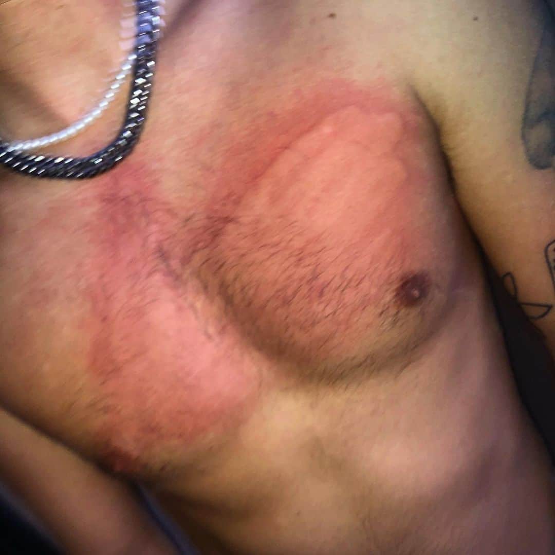 ジャック・ジョンソンのインスタグラム：「beat @sammywilk in beer pong and he was so upset at his lack of athleticism that he decided to give me a full force slap to the chest... everyone go tell him he is a baby on his most recent post I would really appreciate it」