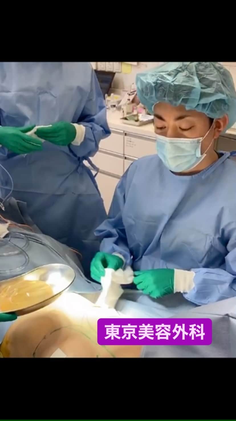 東京美容外科公式のインスタグラム：「銀座院長冨田先生の20年前にご手術を受けられた豊胸シリコン入れ替え手術の模様です。カプセル拘縮や違和感を感じられている方はご相談ください。当院には豊胸手術後にも乳がん検査が出来る「エイバス」という機器も導入しておりますので、合わせてお問い合わせくださいませ☺️ . . 📞お問い合わせはこちら💁🏼‍♀️ 詳しくはプロフィールのURLから公式サイトへ. ▼フリーダイヤル 0120-658-958 （コールセンター受付時間：9：00～21：00） ▼LINE予約 @ tkc110 ========================= #東京美容外科#美容整形#整形#美活#美容#美容外科#特別外来#他院修正#鼻#豊胸#鼻中隔延長#銀座#エイジング#美白#美肌#オンライン#輪郭形成#院長#他院修正#手術動画」