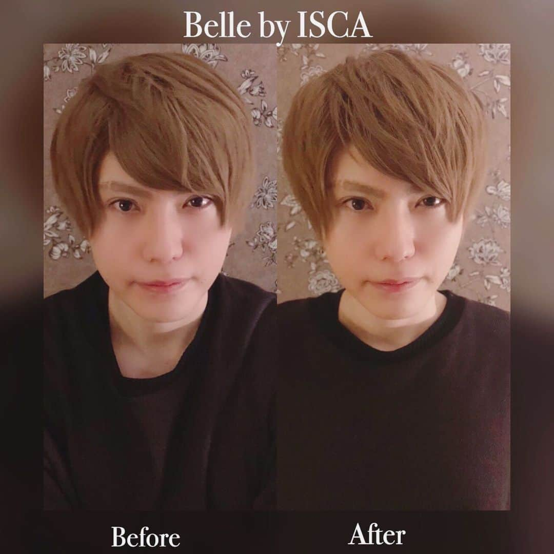 結のインスタグラム：「先日広尾にある整顔Belleに行って来ました。劇的ビフォーアフター✨  I went to the facial beauty treatment salon the other day. My face is smaller than before the procedure.It is Ozawa magic!!  #整顔 #小顔マッサージ  #フェイシャルエステサロン #小顔矯正  #Belle広尾 #ビフォーアフター写真  @belle_mayuko 先生ありがとうございました！」