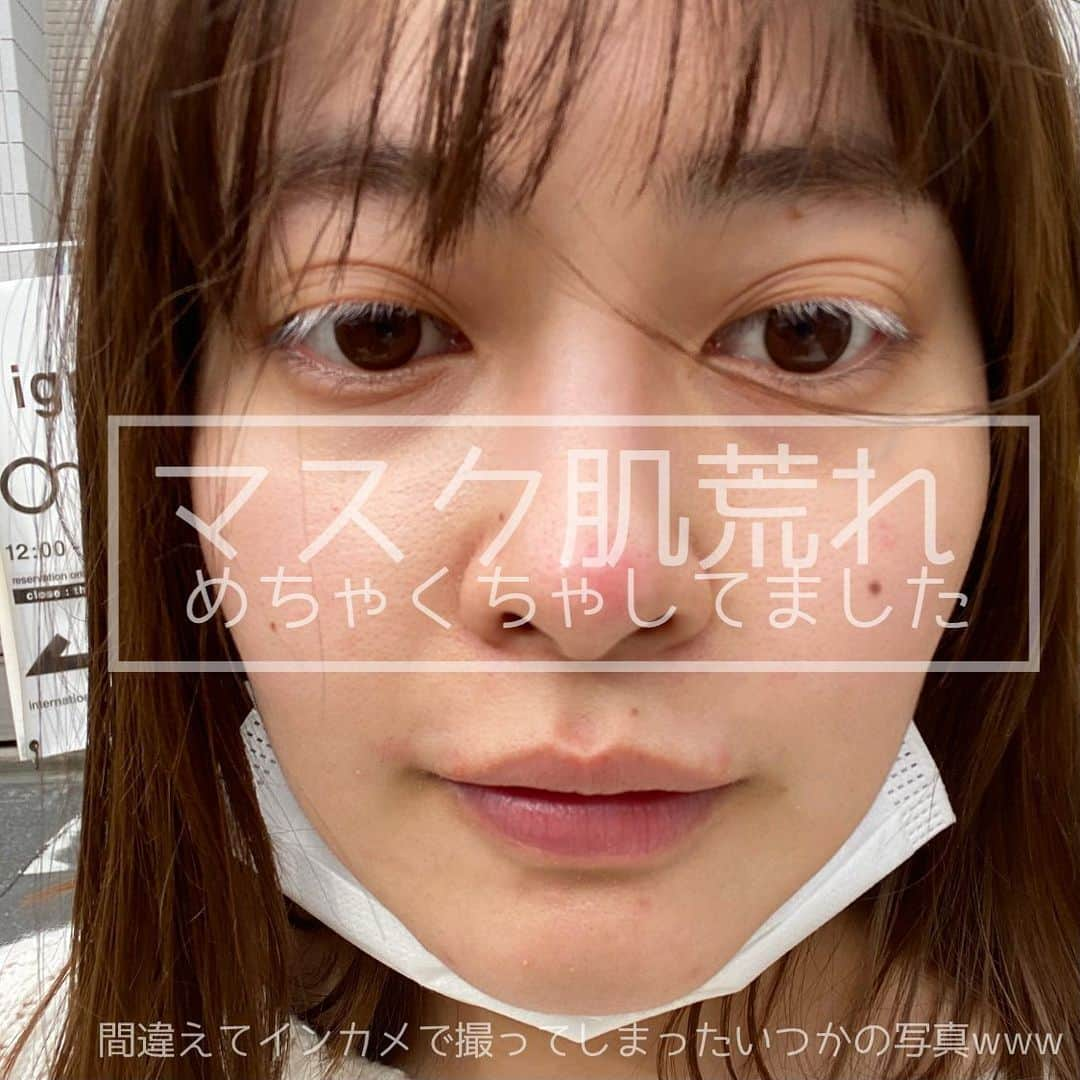 あけちゃるさんのインスタグラム写真 - (あけちゃるInstagram)「ニキビケアをまとめました！﻿ ﻿ 大人になってこんなに肌荒れすることなかったんだけど、マスクの原因で肌荒れに悩んでました🥺﻿ ﻿ マスクの摩擦だったり、マスクつけている時のムレだったりで肌荒れするらしい😭😭😭﻿ ﻿ それでも、やっぱりケアをすればだいぶマシになります！！綺麗になれます！！﻿ ﻿ あとは、やっぱ布マスクのが肌荒れしないなって最近思います🙆🏽‍♀️🙆🏽‍♀️﻿ ﻿  でもまあ、1番は睡眠！たくさん寝ると治ります！！ これがいちばん大事！！！  #ニキビケア #マスク #肌荒れ #肌荒れ改善 #スキンケア #スキンケアマニア #ニキビ跡ケア #マスクの肌荒れ対策 #綺麗な肌になりたい #肌荒れ対策 #ハーブピーリング #韓国スキンケア #韓国スキンケアおすすめ　#大人ニキビ改善 #大人ニキビ #大人ニキビケア #スキンケア紹介 #美肌になりたい #美肌作り #女子力アップ #女子力向上計画」1月18日 19時39分 - akecharuu