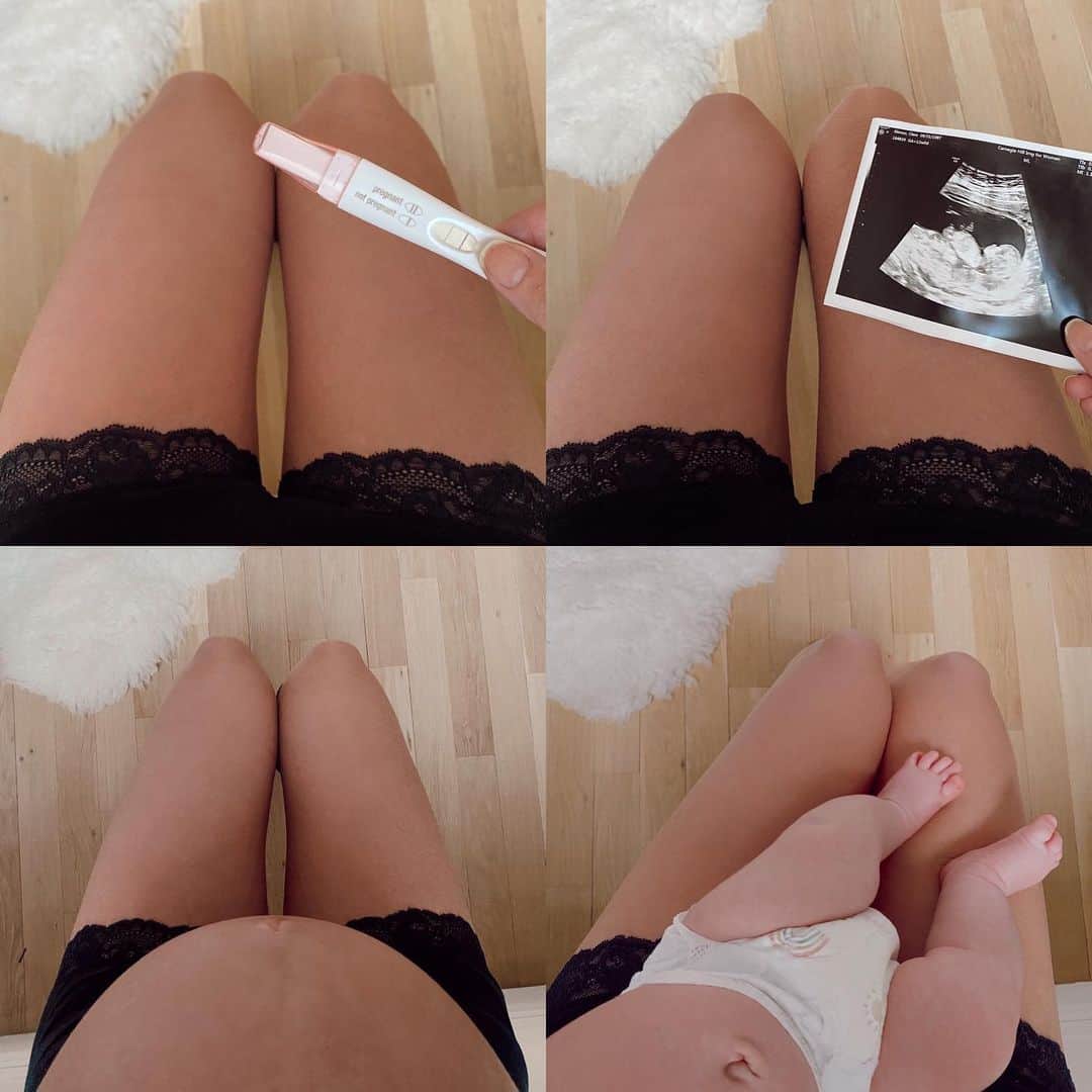 クララ・アロンソのインスタグラム：「How it started vs how it’s going 😍  In love with my little 🐨」