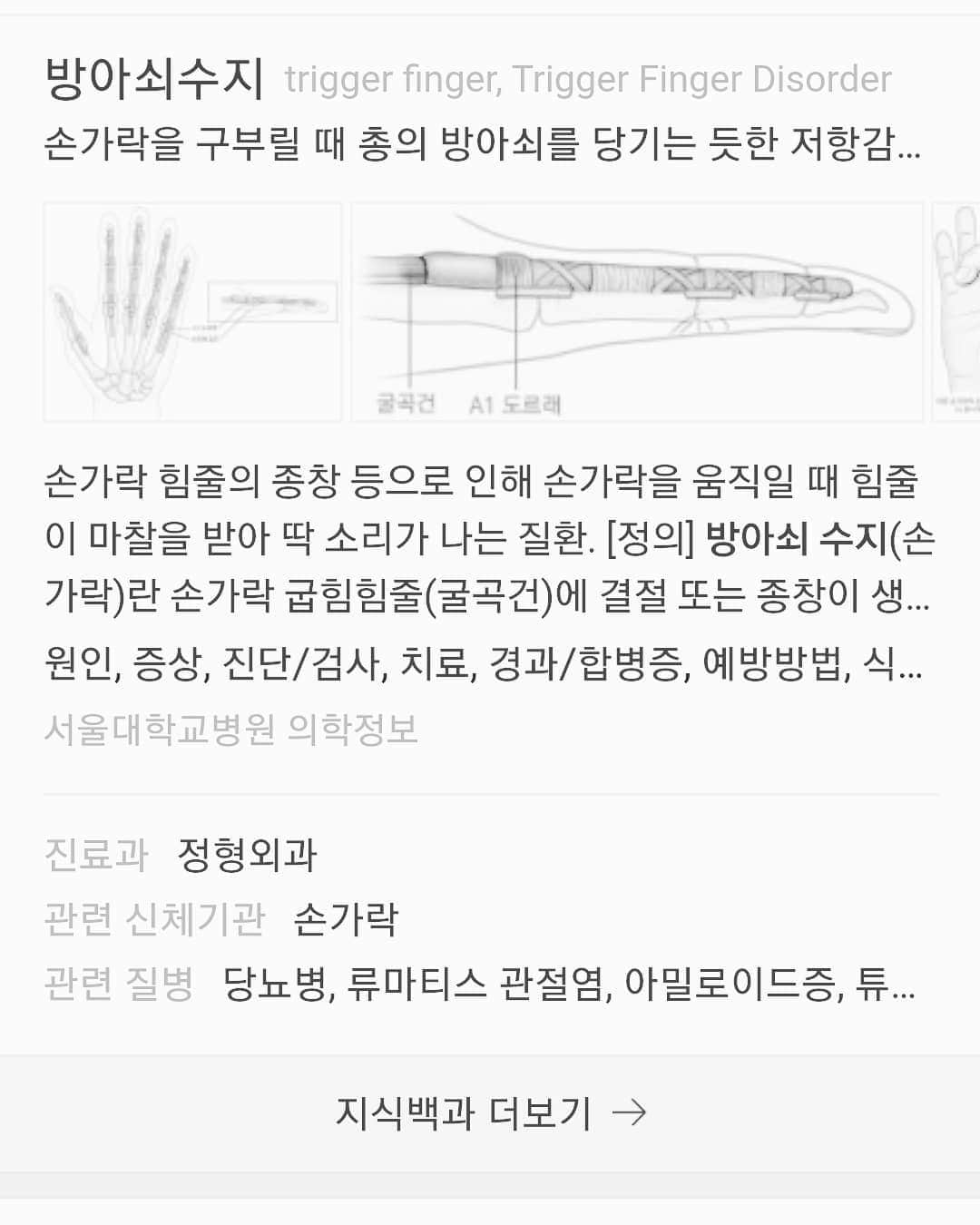 ソン・スンヒョンのインスタグラム：「이거 걸려서 방금 우측 새끼손가락 주사 맞았는데 병원 안내데스크까지 들릴정도로 소리질렀습니다. #방아쇠수지증후군  #triggerfinger」
