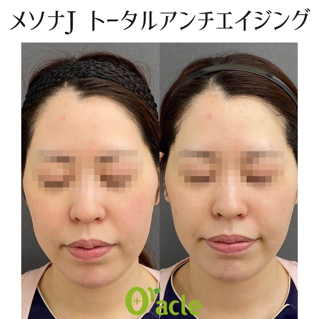 オラクル美容皮膚科東京新宿院のインスタグラム