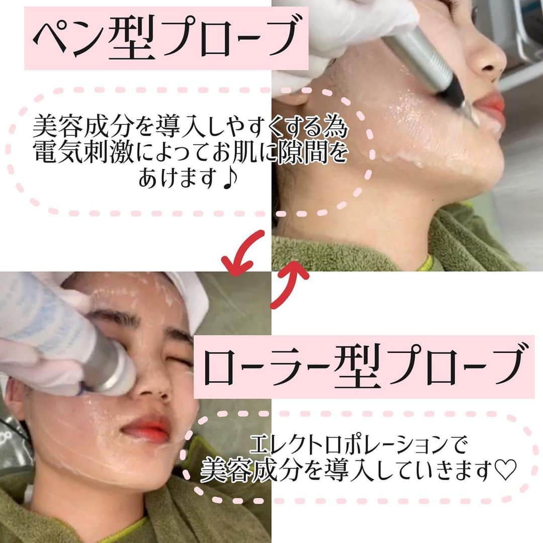 オラクル美容皮膚科東京新宿院さんのインスタグラム写真 - (オラクル美容皮膚科東京新宿院Instagram)「メソナJ・メソナJプラスで美容成分を大量導入✨﻿ ﻿ 美容成分を導入しやすくするため、﻿ お肌に隙間をあけながら導入していきます😊﻿ ﻿ 痛みがなく、ダウンタイムもないです✨﻿ ﻿ ‼️オラクル完全オリジナル‼️﻿ ﻿ 💎ボトックスカクテル﻿ 💎リジュラン﻿ 💎幹細胞﻿ 💎トラネキサム酸﻿ 💎BNLS（脂肪溶解）﻿ ﻿ 👆通常は注射で入れる成分をメソナJプラスで導入可能です✨﻿ ﻿ ﻿ 1月は「メソナJプラス」のトラネキサム酸が1万円引きです⭐﻿ ﻿ メソナJプラス トラネキサム酸(美白)﻿ 1回　30,000円(税抜)﻿ ※通常　40,000円﻿ ﻿ ﻿ ️⚠️リスクなど⚠️﻿ ・施術中に軽いピリピリ感を感じる場合があります。﻿ ﻿ ・電気による刺激やスティックによる摩擦での発疹、施術部位の赤み、かさつきなどが稀に起こる場合があります。﻿ ﻿ ﻿ ▪️▫️▪️▫️▪️▫️▪️▫️▪️▫️﻿ ﻿ 🇯🇵オラクル美容皮膚科🇰🇷﻿ 📍東京新宿院﻿ 新宿3丁目19-4 MLJ新宿8階﻿ ﻿ 📍名古屋院﻿ 名古屋市中区錦3丁目24-4﻿ サンシャイン栄5階﻿ ﻿ 【専門】﻿ ニキビ（跡）／毛穴／シミ／しわ／たるみ／痩身／アンチエイジング／美白美肌治療全般／ブライダル相談／メンズ美容﻿ ﻿ 🗝完全予約制﻿ 👠土日祝日も診療﻿ ﻿ 【予約方法】﻿ ☎0120-905-696﻿ ⏰9:00～21:00［年中無休］﻿ ﻿ LINE、メール24時間📧﻿ LINE🆔 @oracle.jp ﻿ 📩HPメールフォームよりお願いいたします﻿ ﻿ ﻿ ▪️▫️▪️▫️▪️▫️▪️▫️▪️▫️﻿ ﻿ ﻿ ﻿#オラクル美容皮膚科 #オラクル #美容皮膚科 #oracle #メソナj #メソナjプラス #アンチエイジング #美白 #ニキビケア #ニキビ #シミ #くすみ #ボトックス #リジュラン #トラネキサム酸 #幹細胞 #脂肪溶解 #bnls #小顔 #リフトアップ #美容 #美容垢さんと繋がりたい #美容垢 #韓国美容 #韓国 #韓国好きな人と繋がりたい #美肌 #美肌ケア」1月22日 15時37分 - oraclejp