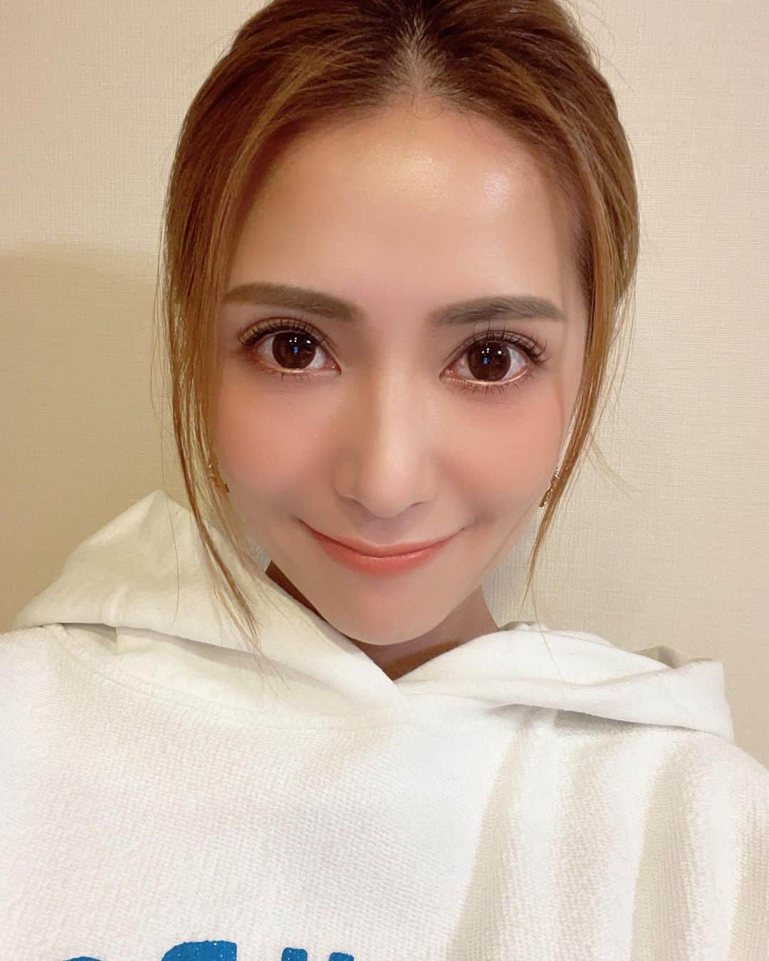 田母神智子のインスタグラム：「注射のおかげでニキビも消えたし、この前やったフォトフェイシャルと定期的にやってるハーブピーリングのお陰でお肌の調子がとても良い✨ ハーブピーリングは月に2回ぐらいやってるんだけど、今年はフォトフェイシャルも月1でやると決めたんだ‼️なのにまだやれてないから早く行かなきゃ‼️💦 ちなみに前回は @imaizumi.sc で「stellar M22」を照射してもらいました。 シミやそばかす以外にも肌のハリやキメも整うとの事😆✨ やった直後からお肌の調子がとても良かった✨  今泉クリニック私のインスタを見たって言えば20％offになるそうです❣️  #今泉スキンクリニック#スキンクリニック#六本木#六本木駅#美容皮膚科#美容クリニック#今泉明子#ヒアルロン酸#ボトックス#ヒアルロン酸注射#ボトックス注射#エイジングケア #ハーブピーリング #12beauty #ニキビ注射」