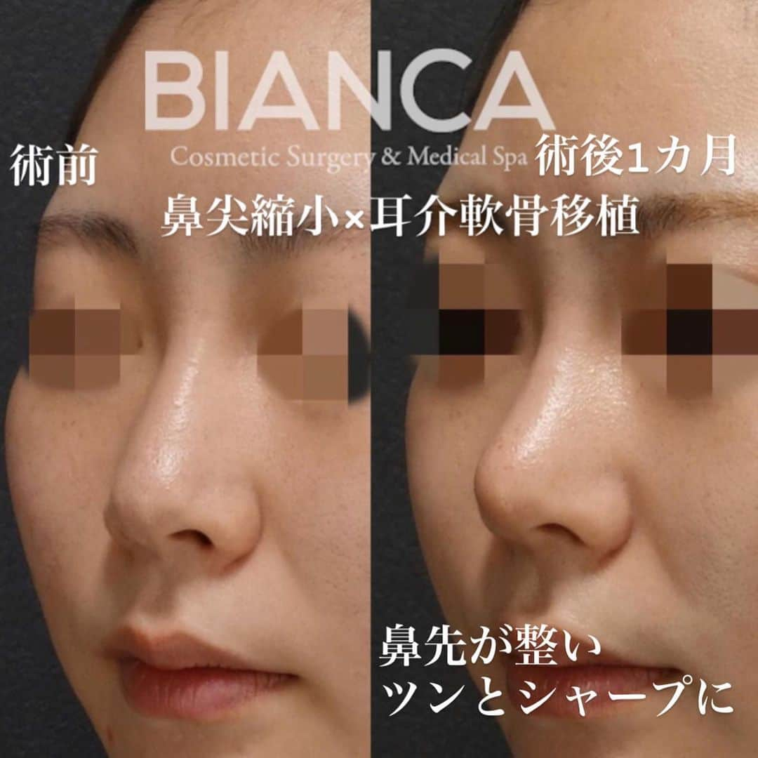 辻沢由有（BIANCA CLNIC 表参道院 院長）のインスタグラム