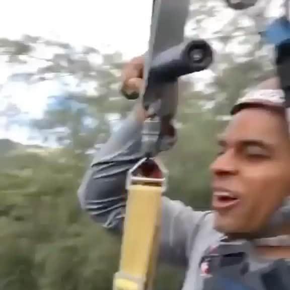 ヤンデルのインスタグラム：「😁🦷」