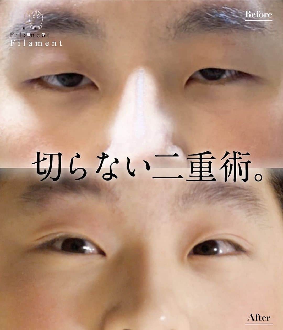美容整体師川島さん。のインスタグラム：「【2月イベント&予約開放】 1月25日21時〜より Filament 4店舗の予約解放と 2月イベントの切らない二重術 『川島式二重整体』の 特別イベントを開始します😌 . ご予約は プロフィールのURL 又は ホームページからどうぞ☺️ . 今月も Filamentの技術をお楽しみください☺️ . 【川島ご予約案内】 それに伴い川島の東京での新規様の施術を 先着10名で募集します。 川島の施術を希望される方は、 DMにてご連絡いただけたら 秘書から御予約案内来ますので、 返信もらった順で締め切りとさせていただきます。 . #整体Filament #整体 #小顔矯正 #二重 #二重整形」