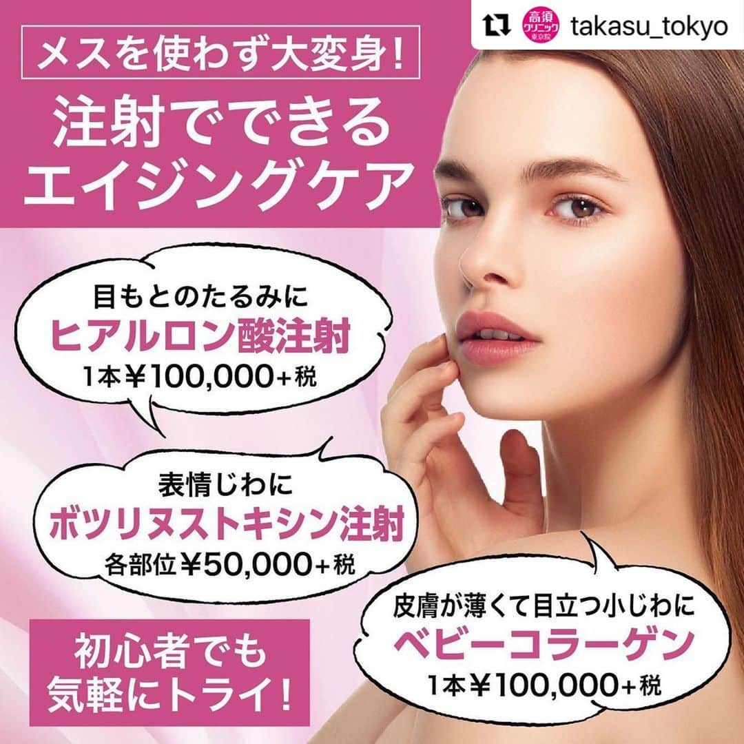 高須クリニックさんのインスタグラム写真 - (高須クリニックInstagram)「. ━･･━･･━･･━･･━･･━･･━ #Repost @takasu_tokyo ━･･━･･━･･━･･━･･━･･━ メスを使わず、注射1本でできるエイジングケアがあります。﻿ 美容医療初心者の方も、気軽にトライしてみませんか？﻿ ﻿ 【🌿料金】﻿ ●注射式シワ取り 長期持続型ヒアルロン酸注入﻿ 1本¥100,000（税抜）［全院］﻿ ﻿ ●注射式シワ取り ボツリヌストキシン注射﻿ 額・眉間・目尻・口周り・鼻の根元ジワ・あごの梅干しジワ 各￥50,000（税抜）［全院］﻿ ﻿ ●ベビーコラーゲン﻿ 1本¥100,000（税抜）﻿ ［全院］﻿ ﻿ 【⚠️副作用・リスク】﻿ ●注射式シワ取り 長期持続型ヒアルロン酸注入﻿ 内出血（注射針が血管に当たってしまった場合）、仕上がりのわずかな左右差（完璧なシンメトリーは不可）、アレルギーが生じる可能性、注入後の感染、血流不全、皮膚壊死、過度にいじったり揉んだりすると腫れる可能性﻿ ﻿ ●注射式シワ取り ボツリヌストキシン注射﻿ 内出血（注射針が血管に当たってしまった場合）、妊活・妊娠・授乳中の方への施術不可、眉が下がる、目が細くなる可能性、目が開けにくくなる、眼瞼下垂になる可能性﻿ ﻿ ●ベビーコラーゲン﻿ 内出血（注射針が血管に当たってしまった場合）、仕上がりのわずかな左右差（完璧なシンメトリーは不可）、注入後の感染、血流不全、皮膚壊死、過度にいじったり揉んだりすると腫れる可能性﻿ ﻿ 【ご予約・お問合せ】 ➿0120-5587-10 ※症例写真や施術に関するご質問なども上記までお願い致します。 ﻿ #高須クリニック　#美容　#美容整形　#整形手術　#整形　#プチ整形　#整形したい　#美容外科　#美容クリニック　#かわいい　#可愛くなりたい　#綺麗　#綺麗になりたい　#美人　#美容好きな人と繋がりたい　#美容好き　#ベビーコラーゲン　#注射式シワ取り　#小ジワ　#シワ 　#肌細胞　#ヒアルロン酸　#ボドックス注射　#目の下のクマ」1月25日 18時23分 - takasu_staff