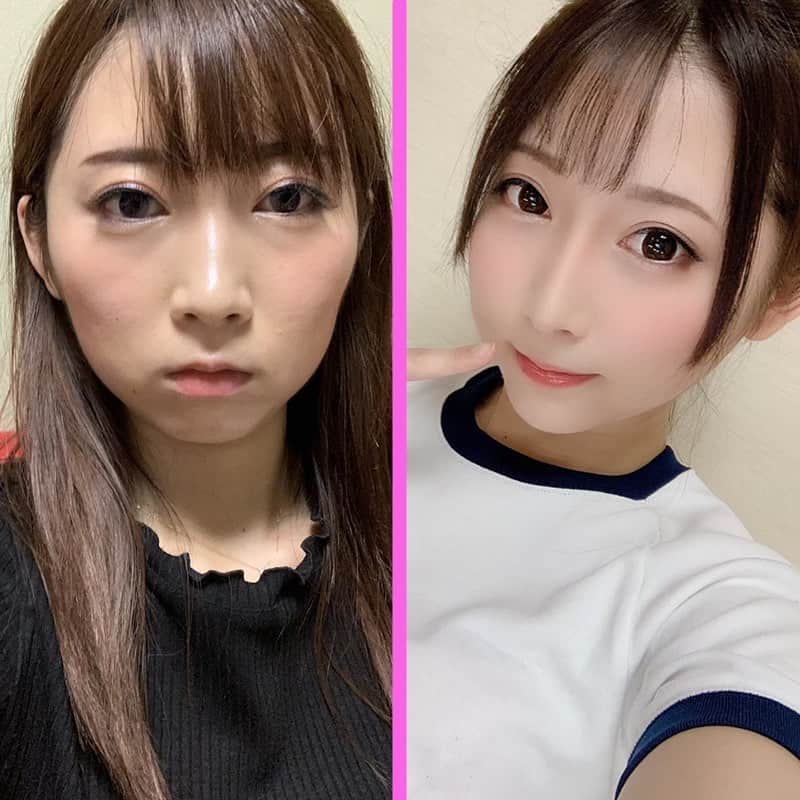 ウォンジン美容整形外科、皮膚科のインスタグラム：「⠀ ウォンジン整形外科 ⠀ ウォンジン2021 輪郭手術モニターモデル募集中‼️ ⠀ 🔸募集項目▶️輪郭手術 🔸人数▶️先着10名様⠀ ⠀ 🔻条件🔻 *写真&レビュー&動画提供とSNSアップ *テレビ電話でのカウンセリング *予約金のお支払い *初手術 ⠀ 人気の輪郭手術(エラ/顎先/頬骨)が 超特価でご提供可能です😆⭕️ ⠀ 新年今だけの大チャンス‼️‼️ ⠀ イベントに関するお問い合わせはウォンジン公式ラインまでご連絡下さいませ📲 ⠀ (美容整形、芸能人の皮膚管理ノウハウ、アイドルのダイエット秘訣など 日本カウンセリング会予約・各種イベントについてもこちらへ💁♀✨) LINE: wonjinの前に@をつけて下さい E-mail: wonjin.jpn@gmail.com ⠀ #원진 #원진성형외과 #wonjin #wonjinbeauty #ウォンジン皮膚科 #ウォンジン整形外科 #韓国美容整形 #韓国美容外科 #韓国整形 #整形 #美容外科 #ウォンジン #美容整形 #韓国美容 #整形手術 #輪郭手術 #モニターモデル募集 #モニターモデル #割引イベント #イベント #モデル募集 #無料相談 #無料カウンセリング #鼻整形 #目整形 #豊胸 #リフト #プチ整形 #皮膚科 #スキンケア⠀」