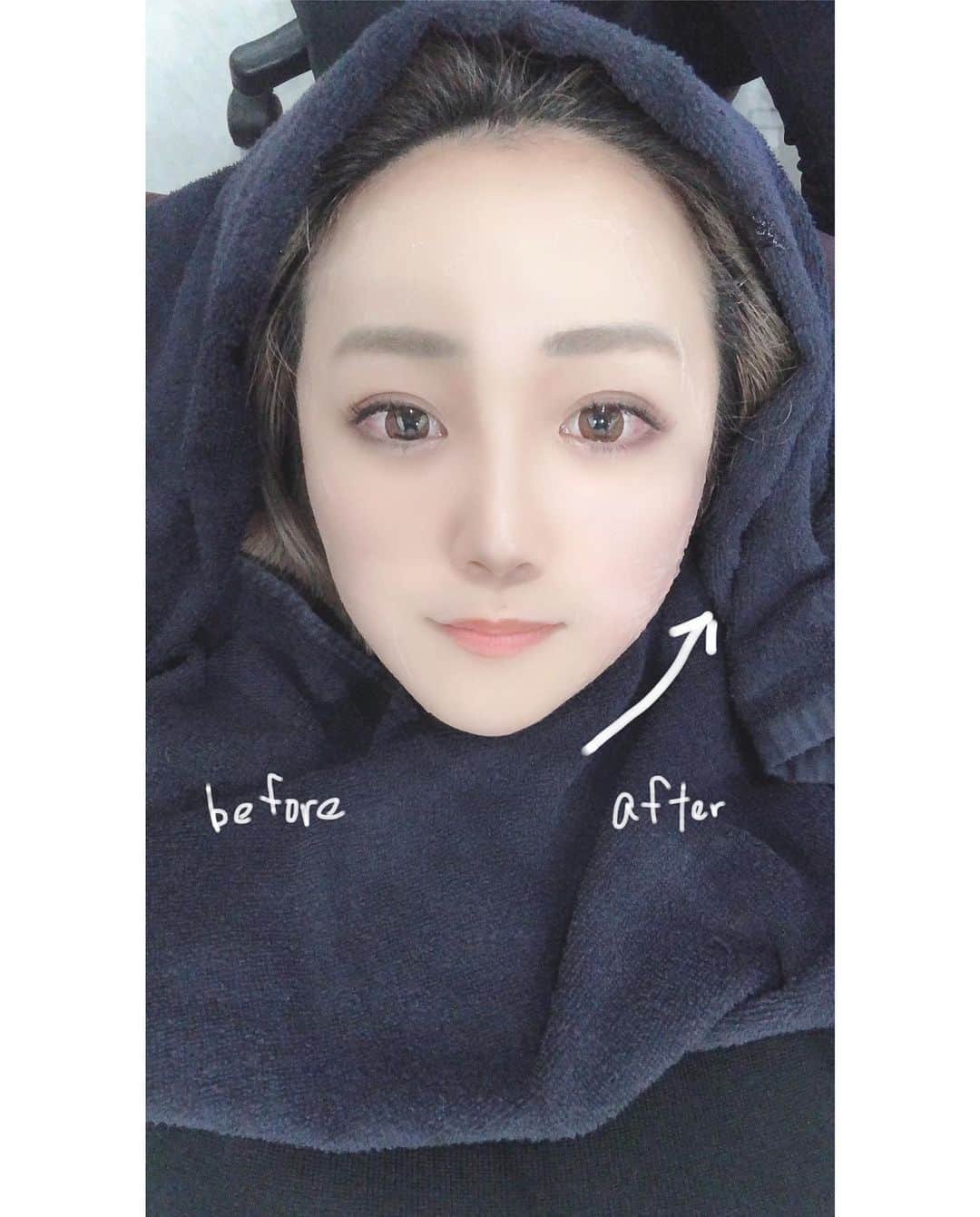 中島絢乃さんのインスタグラム写真 - (中島絢乃Instagram)「🥤☁️☁️﻿ ﻿ ﻿ 仕事前にスタバ寄ったら﻿ 新作のフラペチーノ出てたよ😌💞﻿ #チョコレートオンザチョコレートフラペチーノ 🍫﻿ ﻿ ハートが乗ってるフラペチーノ﻿ まだ飲んでないけど﻿ こっち買ってしまったーーー！😌💭🥤🍫﻿ チョコ大好きだからまた飲みたい😍❤️﻿ ﻿ ﻿ ﻿ ﻿ そういえばこの前、﻿ #eyecandyhifu (@eyecandyhifu )で﻿ #ウルトラVハイフ の﻿ スタンダードコース受けてきました💫﻿ ﻿ 本格ハイフが初回４４００円で施術可能﻿ 2回目以降も9900円で通うことができるサロン🏡﻿ お手ごろな価格で﻿ フェイスラインのもたつきがしゅっとするから﻿ 今あるたるみが気になる人にはいいと思う👀💫﻿ お顔すっきりして今日もがんばる！😍🔥﻿ 𓂃 𓈒𓏸 ‎𓂃 𓈒𓏸 ‎𓂃 𓈒𓏸 ‎𓂃 𓈒𓏸 ‎𓂃 𓈒﻿ #eyecandy#ad @eyecandy_shinjuku　﻿ #HIFU#ハイフ#フェイシャル #エステ#美容﻿ #小顔効果 #アンチエイジング﻿#のんさん美容記録」1月27日 13時21分 - nakajima_ayano