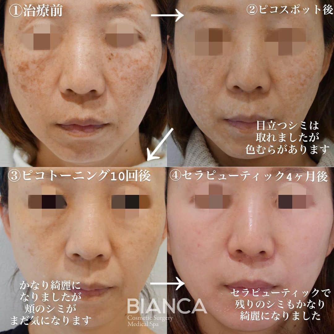 辻沢由有（BIANCA CLNIC 表参道院 院長）のインスタグラム