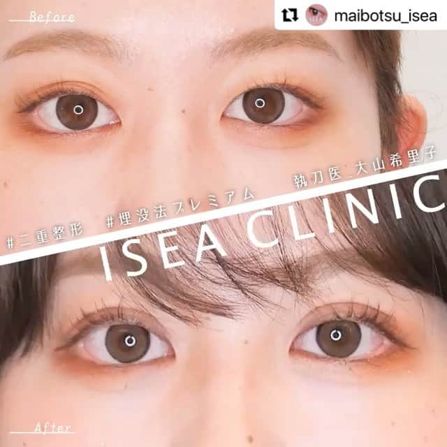 東京イセアクリニックのインスタグラム