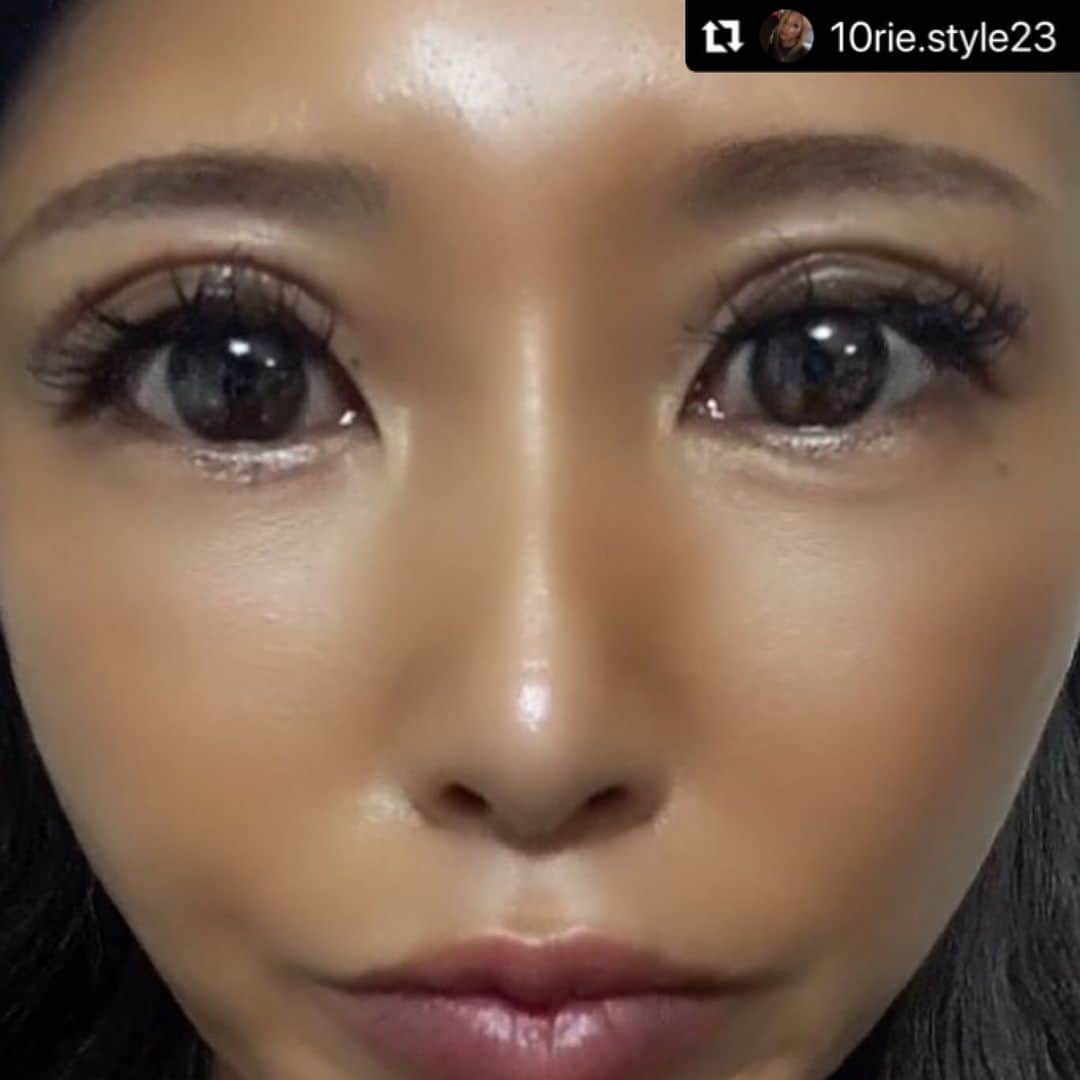 恵比寿フィラークリニックさんのインスタグラム写真 - (恵比寿フィラークリニックInstagram)「﻿ 埋没二重の施術を受けられた方が投稿してくださいました❣️﻿ ありがとうございます☺️﻿ ご満足いただけたようで私たちも嬉しいです✨﻿ ﻿ 埋没二重は切開と比べ、ダウンタイムも少ないので気軽に二重になれる事で人気の施術です🙋‍♀️﻿ ﻿ ダウンタイムのある施術は春休みなどを利用して行うのがおすすめです🙆‍♀️﻿ ﻿ ﻿ 埋没二重﻿ 2点留め(両目)　29,800円﻿ 片目1点追加　15,000円﻿ ※税抜き﻿ ※麻酔代、薬代込み﻿ ﻿ ﻿ ﻿ ﻿ @10rie.style23﻿ ・・・﻿ ずっとしたかった埋没❤︎﻿ 仕上がりが希望通り過ぎて終わってから﻿ ずっとうきうきだった🥰💗﻿ ヒアルロン酸を唇💋に入れて貰った所に﻿ 行ってきたよん！！﻿ 麻酔も笑気麻酔では無くて😳﻿ 目に細い注射💉を打つんだけど全然痛くなかったし逆に先生やスタッフさん達が怖くならない様に😂声かけしてくれて寝ちゃいそうなくらいあっとゆうまに終わった👍🏽❤️﻿ 欲張りな二重を希望したから少し腫れてるけど思ったより全然綺麗で痛みもなく🥺✨﻿ 理想な目にしてくれて本当に大満足💖﻿ 三点留めで59800円❤︎﻿ 相談も進め方も凄く丁寧で私の顔面は﻿ ここで綺麗にしてもらってます👁💋﻿ 水野の先生は見た目からして優しそうな方で﻿ 細かくちゃんと理想を聞いてくれて﻿ マツエクまで気にしてくれて😂﻿ 本当に優しかった🥺🥺🥺✨﻿ 技術が本当早くて本当に上手過ぎた🥺🙏🏽﻿ 綺麗な平行二重に❤️❤️❤️﻿ 私の希望は腫れてる時の幅が理想と言いました！欲張りました🤣やるなら幅広くしたいもん😂欲張り埋没です❤︎﻿ 是非検討してる人は水野先生に頼むべし👍🏽﻿ #フィラークリニック新宿院 ﻿ #フィラークリニック ﻿ #埋没 ﻿ #水野先生﻿ #綺麗な平行二重 ﻿ #上手 ﻿ #二重整形﻿ ﻿ #埋没二重 #プチ整形 #アイプチ #アイプチ卒業 #二重 #二重埋没法 #二重メイク #二重幅」1月29日 10時38分 - filler_clinic