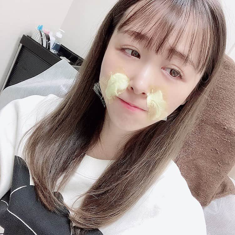 柴小聖さんのインスタグラム写真 - (柴小聖Instagram)「プルージュ美容クリニックさんへ。 @pruge_clinic   ちょっと前にストーリーにも載せた 自分の血液でお肌を若返らせるやーつ♡ 順調に経過してます☺️✨  いつまでもぷるぷるでいたいです🍓  #skincare #beauty #clinic #美容  #お肌ケア #피부관리  #ぷるぷる注射 #プルージュ美容クリニック」1月29日 23時19分 - konona.official