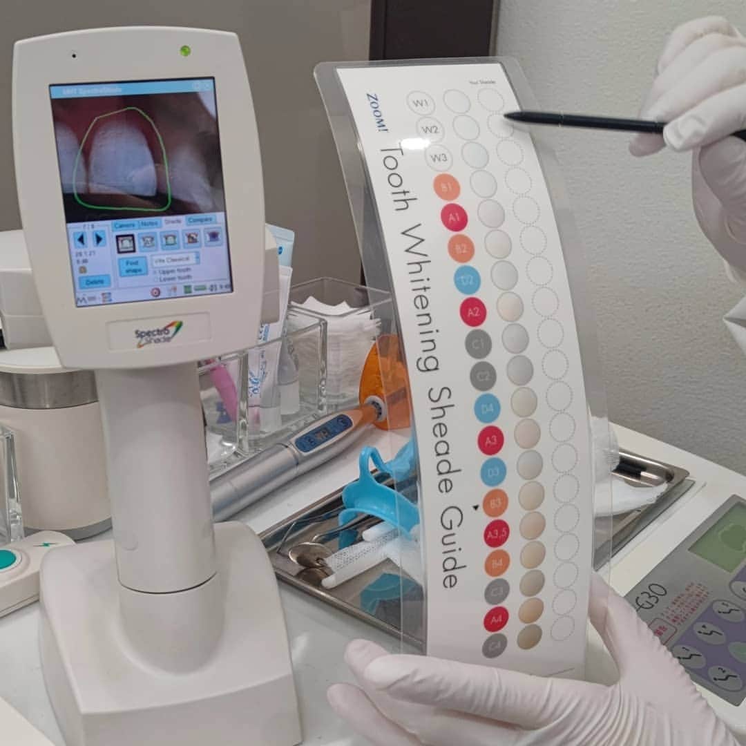 松浦麻里奈さんのインスタグラム写真 - (松浦麻里奈Instagram)「@whitening_tokyo　ホワイトニング東京にて😋🐾 通院1回で輝く白い歯に🤗🌸ここの特徴は機 械で 歯の色チェック！！  目で見るよりも、機械で判断してくれた方が ビフォーアフターで納得の安心出来る💓  ▶納得いかない場合、全額返金保証、もしくは再施術！ ▶お口に入れる器具が、 舌をガードしてくれる構造の器具なので疲れない✨  ▶歯茎に特殊なジェルをつけて、歯につける薬剤が 歯茎に浸透しないように程よく歯茎のジェルを固める。  一回痛みはあったものの、そのあとは全然痛みなし♂ というのも、普段ホームホワイトニングやってたので 慣れてたのかも？ホームだとやっぱり根本 なかなか白くならなくて気になってたけど 白くなって嬉しい♥♥  ▶最後に染み止めを歯茎に塗ってくれる。 ▶心配な方は痛み止めを最初のうちにくれる。  ホワイトニング先進国アメリカで シェアNo.1を誇る最新ホワイトニング✨  歯の内側から歯を漂白して 白くする歯科医院の本格ホワイトニング🐾  ご予約の際に、私のインスタを見たと言うと3,000円割引き🧏 「ホワイトニング東京」で検索してみてね♥  #ホワイトニング#ホワイトニング東京 #ホワイトニング恵比寿#ホワイトニング専門店 #輝く白い歯#白い歯#白い歯になりたい #ホームホワイトニング#歯　#口元#口元美人 #歯みがき#歯医者#ケア#美容#美容好き ウーミーpr #pr」1月30日 15時44分 - ay114.831m