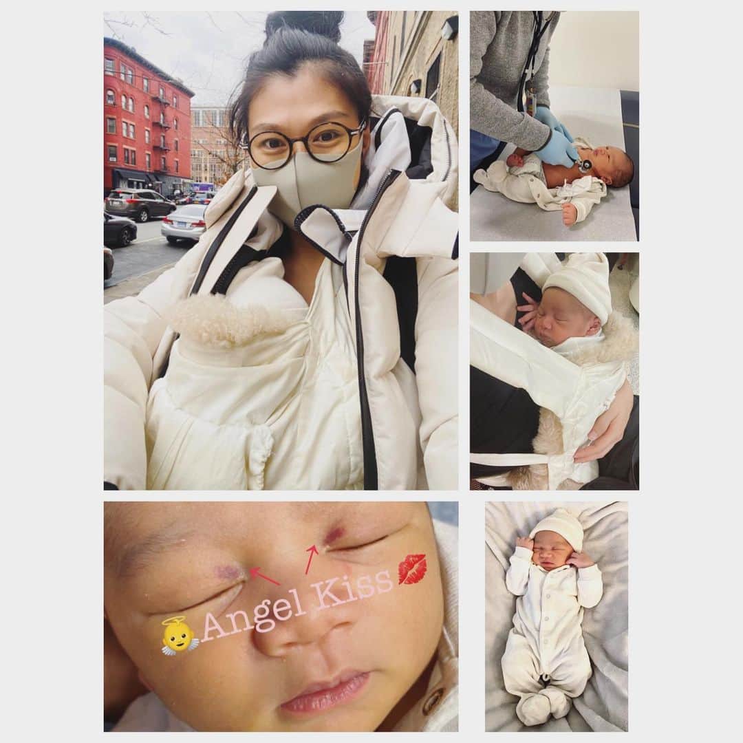 中鉢明子のインスタグラム：「Did you know “Angle Kiss”? It will disappear soon. Dr. said I pushed to my baby out really hard that’s why. 😂👏 #YES #9lbs4ozBaby #HomeBirth #naturalbirth #1weekold #checkup 生後１週間の検診へ #赤ちゃんはじめての外出 3番目は生まれたときからまぶたと目の中に充血がありました。エンジェルキスと言って時期に消えるそうです。ドクターに「相当な力でいきんだでしょう」と言われました(笑) #はい😂 いきんだ時にできたそうです。決してつるんと出てくるサイズではなかったので本当に今までで一番力強くいきみましたから(笑) #4196g赤ちゃん #自宅出産　#自然分娩　#息子 #ニューヨーク #生後１週間 #エルゴ #ergobaby」