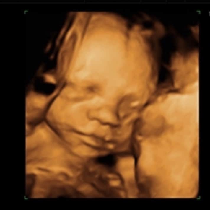 のインスタグラム：「Say hi to our baby bear ❤️🐻 we got our private 4d ultrasound yesterday 🥰 CJ and @cbuckner_ finally got to see little Cam 🤗 #boymom」