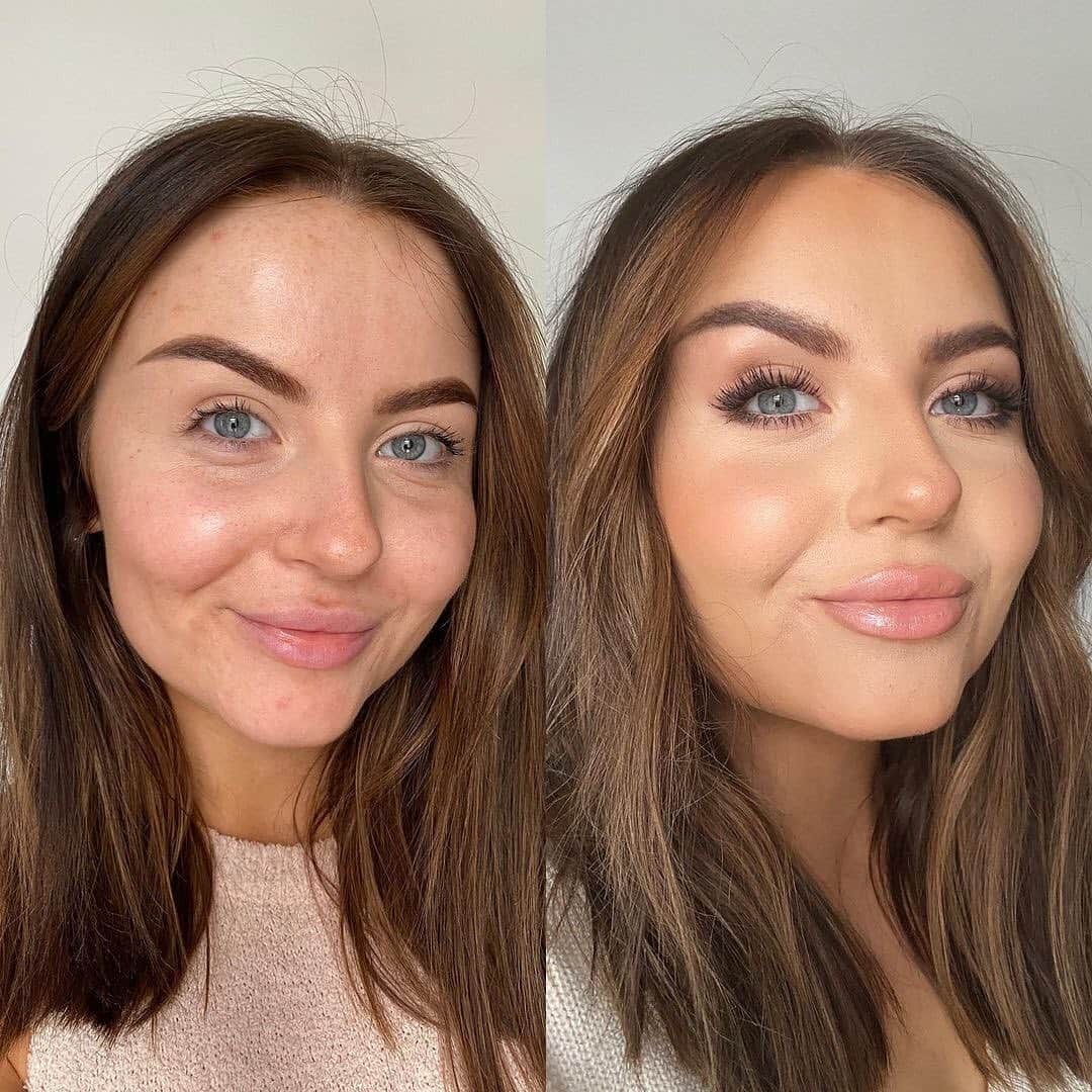 Huda Kattanさんのインスタグラム写真 - (Huda KattanInstagram)「Same beautiful woman, @abbiebull_, new & improved #FauxFilter made by you guys 🙏🏽 Love you soooo much gorgeous 💕💕 #repost "My before & after now compared to 2 years ago! Thought it’d be cool to do this since the original post was me showing coverage of @hudabeauty faux filter foundation and 2 years later shes released a new one! Also a reminder that hard times don’t last forever... My journey with acne was rough but I’m thankful more than ever for who I was then as she made me so much stronger today 💗 #skinpositivity #fauxfilterfoundation"」2月1日 19時59分 - hudabeauty