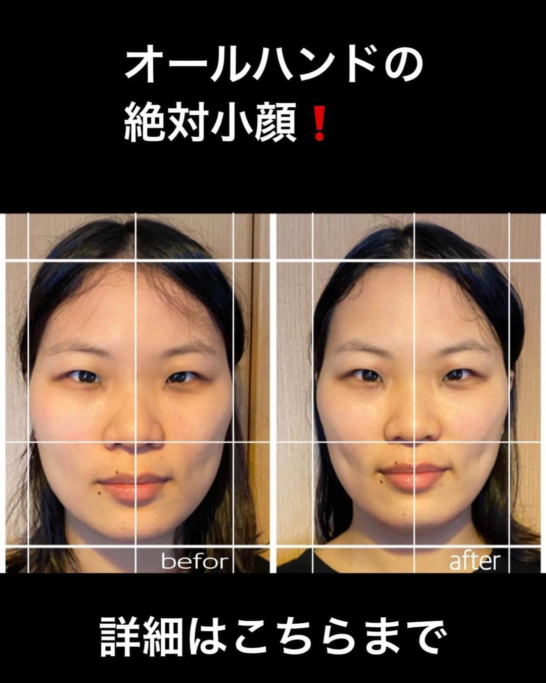 ささきえりさんのインスタグラム写真 - (ささきえりInstagram)「必ず結果を手渡しする事をお約束🔑✨  【絶対小顔体験会のご案内】  大顔でお悩みの方へ♡  リバウンド無し、ダウンタイム無し、憧れの小顔を叶えてみませんか⁉️  令和はオンラインの時代❗️ zoom映えする小顔になりませんか⁉️  ボディメイクの大会で、自分のなりたいを叶えた私がお役に立てる事を✨  ⬇️こんな方にオススメ⬇️  ✅美容整形には抵抗がある方！ ✅美容整形の失敗リスクには抵抗があるけれど、小顔には興味ある方！ ✅リバウンドしたくない！ ✅ダウンタイムが嫌だ！ ✅自分でもケアしていける㊙️テクニックを伝授して欲しい方！ ✅昔から、顔が小さいねと言われた事がない！でも、一度は言われてみたい方！ ✅集合写真の写真映りで、昔の自分と思いっきり差をつけたい方！！  美しくいる事でご機嫌を♡  大顔でお悩みの方、個別相談会&体験会のご案内はこちらから♡  興味のある方は、特別に空席🈳をご予約させていただきますので、お気軽にメッセージをお待ちしております❗️  #アトリエエリー　#絶対小顔　#絶対小顔になってやる  #ダイエット　#トレーニング　#traning #ベストボディジャパン #サマスタ　#筋トレ女子　#世田谷小顔　#梅ヶ丘小顔　#小顔マッサージ #美容整形　#腹筋女子　#美尻　#美脚　#小顔　#diet #痩せたい #ダイエッター #女性起業家　#銀座ママ　#セレブ　#ニコリー」2月1日 19時24分 - chaneri_ballet_style