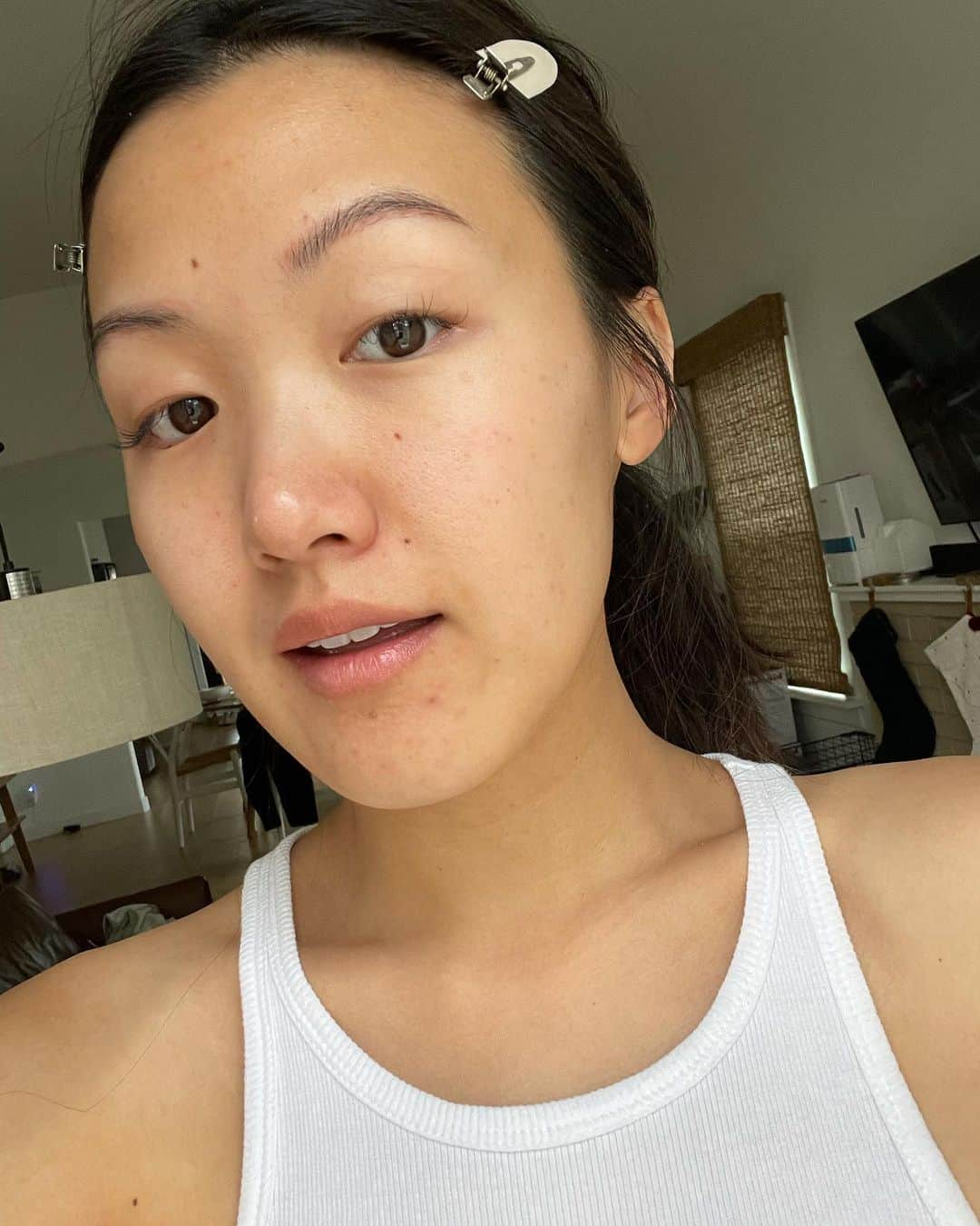 W E Y L I Eさんのインスタグラム写真 - (W E Y L I EInstagram)「Hope you all had a great weekend! It’s been 2 weeks since I first tried micro needling and here’s my update! Swipe for an unfiltered photo of how my skin is looking after 2 weeks. (First photo is just color corrected, no face tuning!)  I added to my Skin highlights my whole experience in case you missed it! I first decided to try microneedling after hearing about how it helps improve the skin by creating small wounds on your face so that your body will create more collagen and elastin = more glowy skin. I’ve struggled with acne since I was a teenager and while that has improved a lot over the years, I have enlarged pores and scars.   My overall experience was NOT painful at all and if you know me, you know I’m TERRIFIED of needles. They put numbing cream on your face, so that helps a lot! It felt sorta like a gentle vibration on the skin. My skin was pink and peeling for the first 2 days- felt just like a sun burn. The peeling lasted about a week! Initially I did not notice a huge difference, as this is something that can take up to four to six weeks since it takes time for your body to create new & healthy collagen. I noticed this weekend that my makeup applied more smoothly and the pores around my cheeks look smaller. The scars on my chin from hormonal acne looks slightly lighter and I noticed I used less concealer in that area. Overall, I’m happy with my results after just one session! I was told most people see the best results after 2-3 sessions, so I can’t wait for that! I did not expect this to be a magical treatment as skin care takes time and also depends on diet & lifestyle. I used to get facials twice a month when I was battling with lots of acne and that took months before things started clearing up. Thank you @facileskin for the amazing experience! I felt super comfortable throughout the whole process and they have given me such great skin care advice that has changed my skin in the last few months. I highly recommend seeing @bell.yoo for your skin care needs 🌸」2月2日 4時04分 - weylie