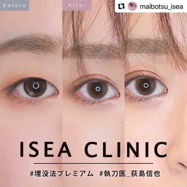 東京イセアクリニックのインスタグラム