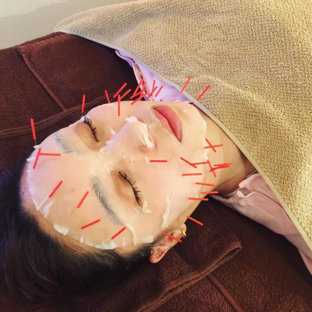唯可（yuika）さんのインスタグラム写真 - (唯可（yuika）Instagram)「あったかかったので 素足で頑張ってみたけど普通に寒かったです。アラサーはタイツストッキング必須という事を改めて学びました🕊 . . この前撮影の前にずっとお世話になってる @ishii_yukio 石井先生の 広尾サロンにまたまたお邪魔してきました！！ 全身整体でがっつり身体を治してもらって そのあとはずっとやりたかった美容鍼🥺🙏 もうこれがほんっとに顔が引き上がるし 幹細胞パックがすごくよくて 次の日のお肌プルップルでした💪 顔のたるみとか歪みとか気になる方は是非石井先生の元へ👨‍🏫✨ . . . #美容鍼#小顔矯正#高身長#高身長コーデ#長身女子#歪み#全身整体#小顔#コーディネート#ジャケット#ニット帽#素足#ザラ#シャネル#アラサーコーデ#長身コーデ#channel#tallgirl」2月2日 19時54分 - yu.i.k.a