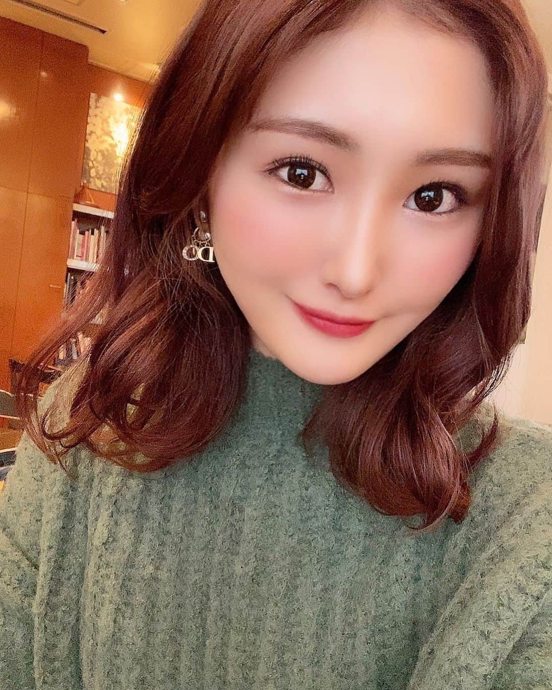 川上礼奈のインスタグラム：「. 先日 #aclinic で山田哲雄先生 @a_clinic_ginza に Aスレッドを施術していただきました☺️✨ 施術中も痛みも全然なかったけど1週間経っても 痛みなくどんどんフェイスラインがスッキリしてきて 毎日感動😳✨ 悩んでた頬コケの部分もふっくらして周りからも優しい雰囲気になった！って言ってもらえて嬉しすぎ😭✨ バランスを見ながら自分に合った最適な施術をしてくれるからフェイスラインの事で悩んでる方は山田先生に相談してみてね😳✨ 美容ってほんと楽しい！！！！ #aスレッド #aclinic #aclinic銀座 #aclinic横浜 #aクリニック #美容 #小顔 #美肌 #リフトアップ #糸リフト #美容外科 #美容皮膚科 #美容クリニック #山田哲雄 #エッグフェイス #卵型ヒアルロン酸注入 #ヒアルロン酸 #ヒアルロン酸ほほ#頬コケ」