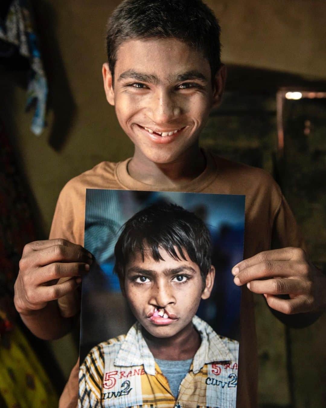 エリック・ウィンターのインスタグラム：「I love working with this organization... Last year, @operationsmile provided more than 3,000 psychosocial consultations to children living with cleft conditions. Mental health plays a vital role in a child’s development. Join me and celebrate #ChildrensMentalHealth Awareness Week by learning more about Operation Smile and their transformational work.」
