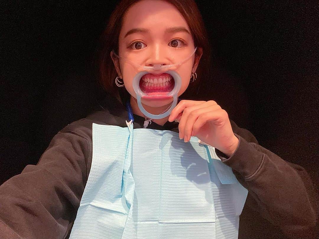 富久美玲のインスタグラム：「_ . お久しぶりのホワイトニング〜👄✨ . トーンチェックで元々の私の歯の色が 前から2番目で白い方だったのですが 1回で更に2トーン白くなりました😳 . そして初の水素吸引！！！ (鼻のチューブで水素吸引をしてます) . ここではセルフホワイトニング中に 色んなオプションが付けれました👍 . 美意識あげていきたいです＼(^o^)／ .」