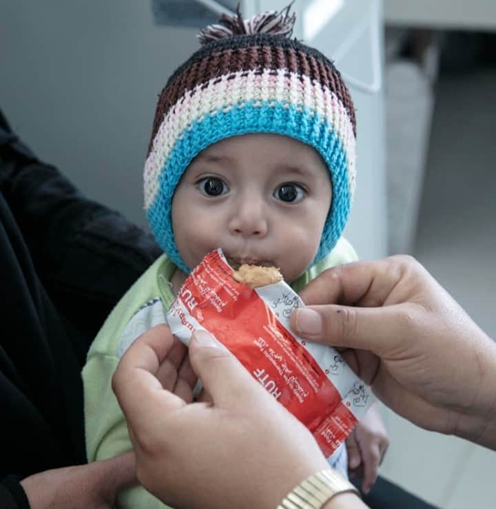 unicefさんのインスタグラム写真 - (unicefInstagram)「Seven-month-old Moheb is receiving urgent treatment for malnutrition at a UNICEF-supported hospital in Sana’a, Yemen.⠀ ⠀ A toxic cocktail of conflict, poverty and COVID-19 is pushing Yemen to the brink of famine. We need urgent funding to prevent a catastrophe and save children's lives, yet so far UNICEF’s appeal is less than 20% funded. ⠀ ⠀ Today, a high-level meeting at the UN could be a critical turning point. Please share this post to your stories and help us tell the world #YemenCantWait. ⠀  © UNICEF/UNI312535/Alghabr」3月1日 14時15分 - unicef