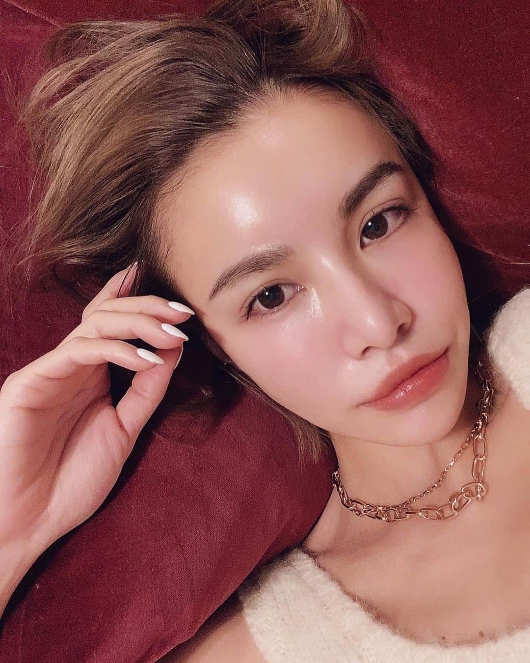 難波サキさんのインスタグラム写真 - (難波サキInstagram)「ダーマペンってなに？どんな感じ？という質問もよく頂くので今回細かく詳しいレポートをお届け🙋🏼‍♀️スライドしてムービーみてね👐🏼  今回紹介するのは赤羽にある @pruge_clinic ❤️  ↓PRPのダーマペンはこんな感じ↓ コラーゲン生成を促すことで、皮膚の再生をしてくれるよ✨PRPは成長因子の濃度が高いからおすすめの理由⭐️  ①自分の血液から抽出した「活性度100%」の成長因子を、細かい穴をあけた真皮にダイレクトに浸透させる、究極の美肌再生治療。なのでまず採血します💉  ②表面麻酔クリームを顔に20-30分塗布。  ③超極細針で微細な穴を開けて、成長因子やヒアルロン酸を浸透させます。  ④傷ついた皮膚組織が回復する過程で、コラーゲンの生成が促されます。皮膚が再生し、さまざまなトラブルが改善されます。  ⑤最後はさらに成長因子を塗ってパックをして終了！  超極細針がついたペン型の電動ニードルを皮膚に当て、高速振動で微細な穴を開けるマシン。開けた穴から成長因子やヒアルロン酸などの成分を浸透させて傷ついた皮膚組織が回復しようとする過程でコラーゲンの生成が促されることで、皮膚の再生が活発になり、気になるシミ、シワ、たるみ、毛穴の開き、にきび跡、クレーター（陥没）、妊娠線、二の腕のぶつぶつ（毛孔性苔癬（もうこうせいたいせん））などが改善されます‼️  症状に合わせて針の長さをセレクトできるのもダーマペンの良いところ✌🏼ダーマペンの針にはさまざまな長さがあるの！それぞれのお悩みの症状に合った皮膚の層に届くよう、針の長さをセレクトしてくれるよ✨  ダウンタイムも針の深さによって個人差があるからだいたい一週間は余裕見ておいた方がいいよ⭐️私はおでこ特に気にならなかったから今回はおでこめっちゃ浅く打ってもらったからマスクしてたら余裕だよ！ダウンタイムも短くしたい人とか初めてで不安がある人は浅めに打ってもらうのがいいかもね😉  #ダーマペン4  #ダーマペン経過  #ダーマペン効果  #美容マニア  #美容ネタ」3月3日 19時05分 - sakinanba