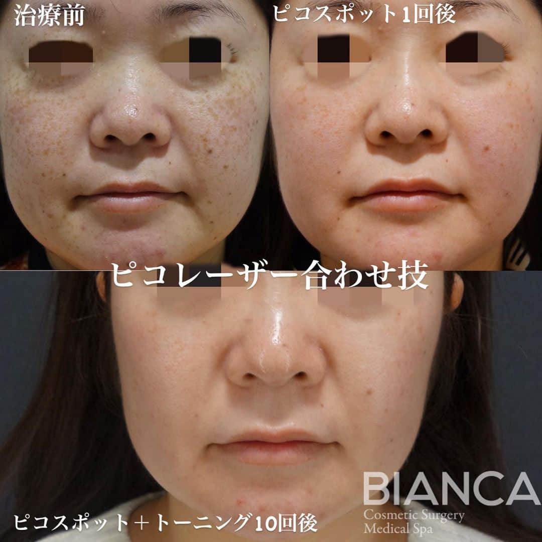 辻沢由有（BIANCA CLNIC 表参道院 院長）のインスタグラム